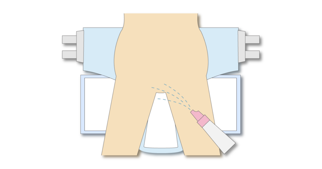 陰部洗浄時にフラット型シートを下に敷くイラスト