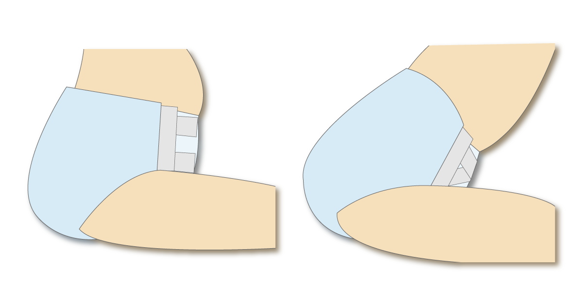 テープ型おむつを着けて座った姿勢と前かがみの姿勢を比較した図