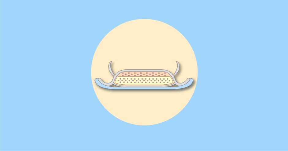 大人用紙おむつの尿とりパッドの断面を描いたイラスト