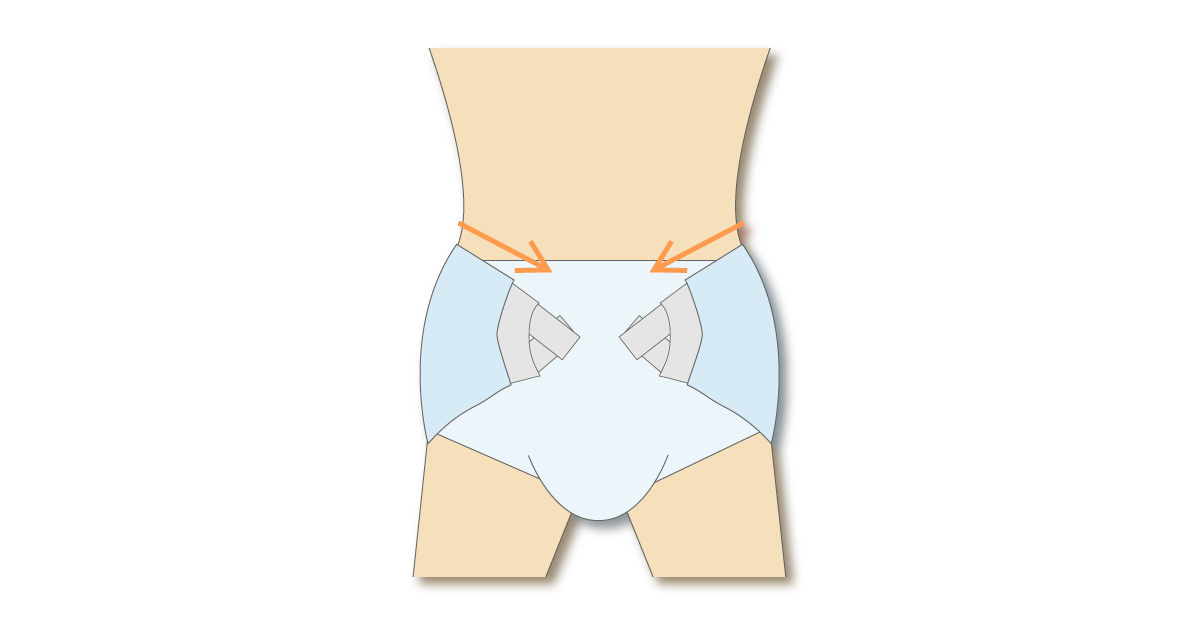 テープ型紙おむつを骨盤上部で固定してずれを防ぐ図