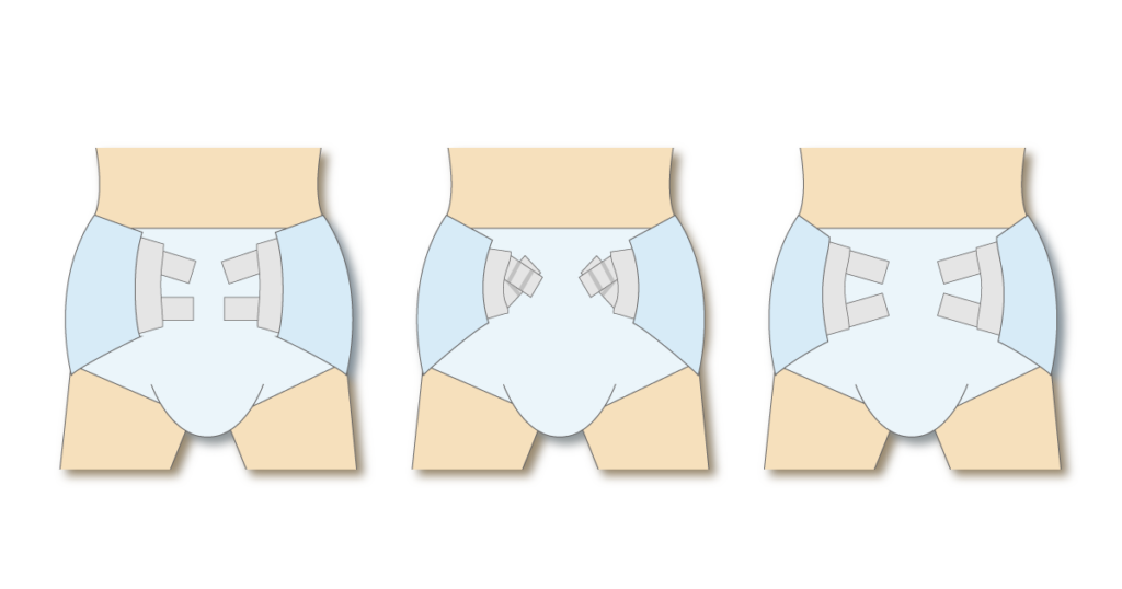 テープ型紙おむつのテープの止め方を3通り比較したイラスト