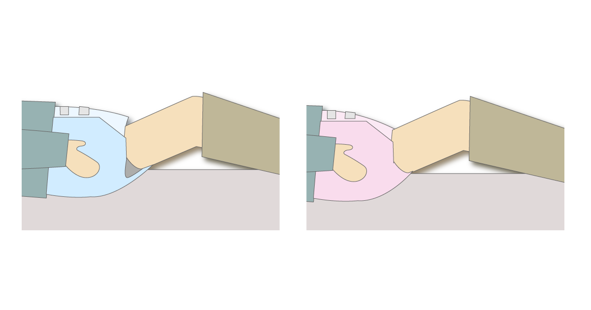 サイズの違うおむつで脚まわりの隙間を比較した図