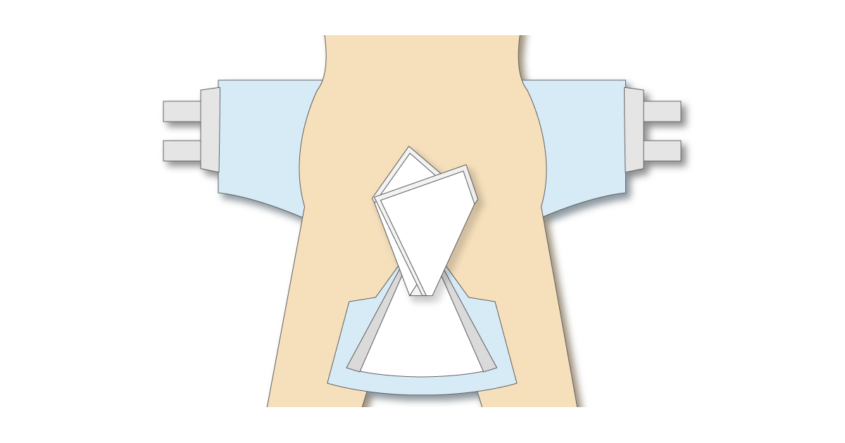 テープ型おむつと両面吸収シートを男性巻きにする図