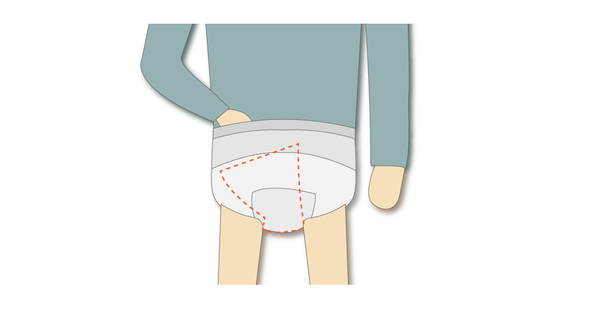 パンツ型紙おむつの中で尿とりパッドの位置を直す様子