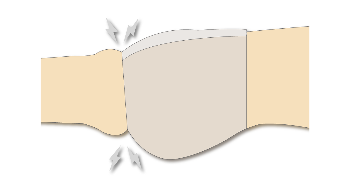 Tightness around the thighs with openable pad-holding pants